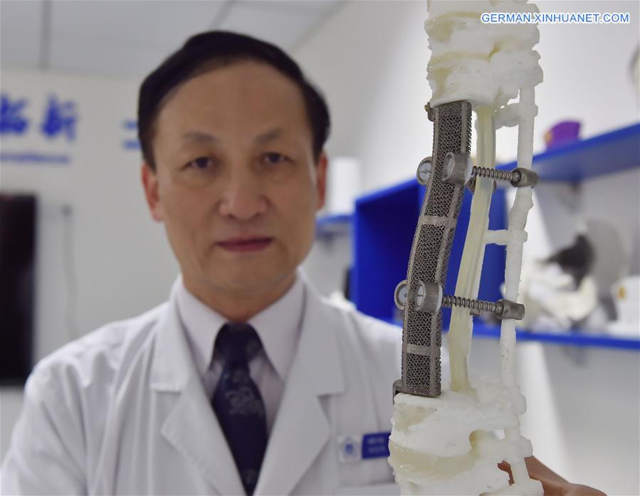 CHINA-BEIJING-3D PRINTED-VERTEBRAE-IMPLANT (CN)